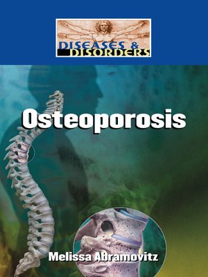 cover image of Osteoporosis